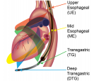 Heart Probe Diagram